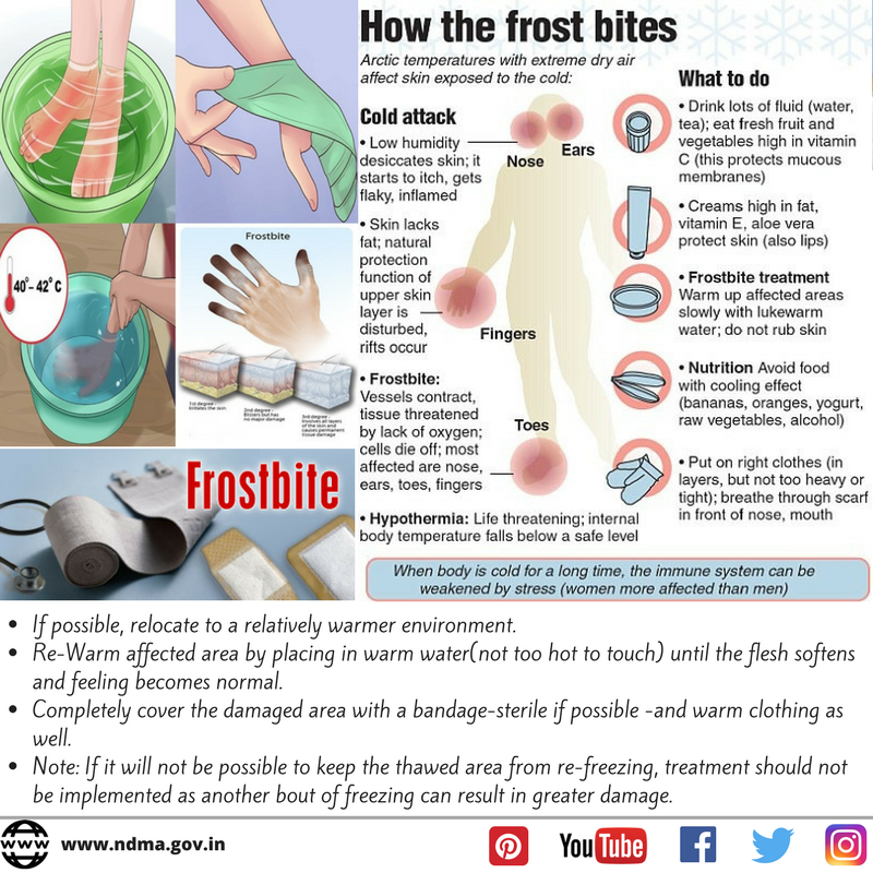 Protect yourself from frostbite